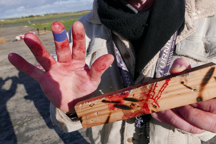 20160210 Chopped finger