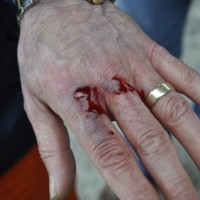 chopped finger club  